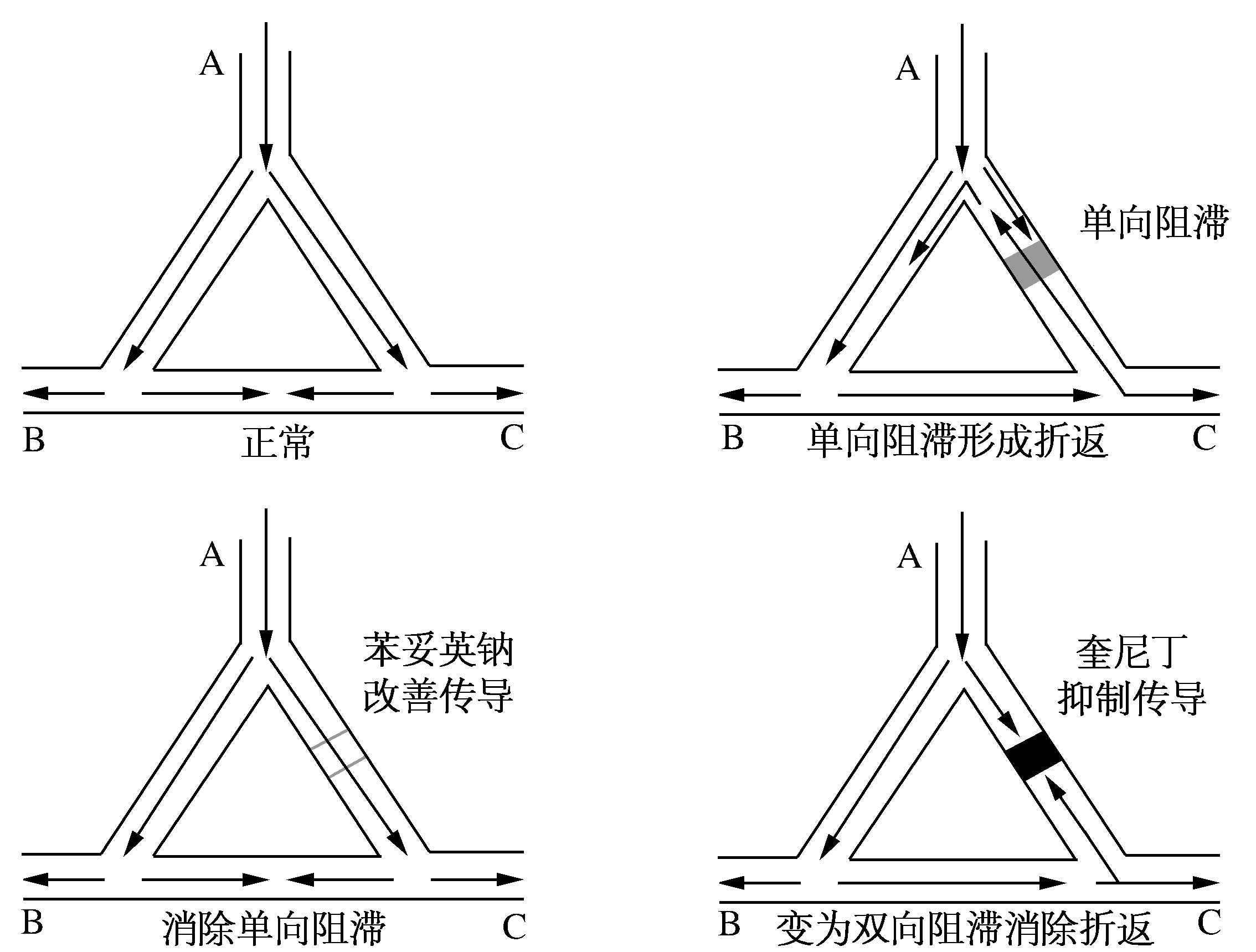 折返激动示意图