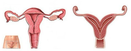 双角子宫.png