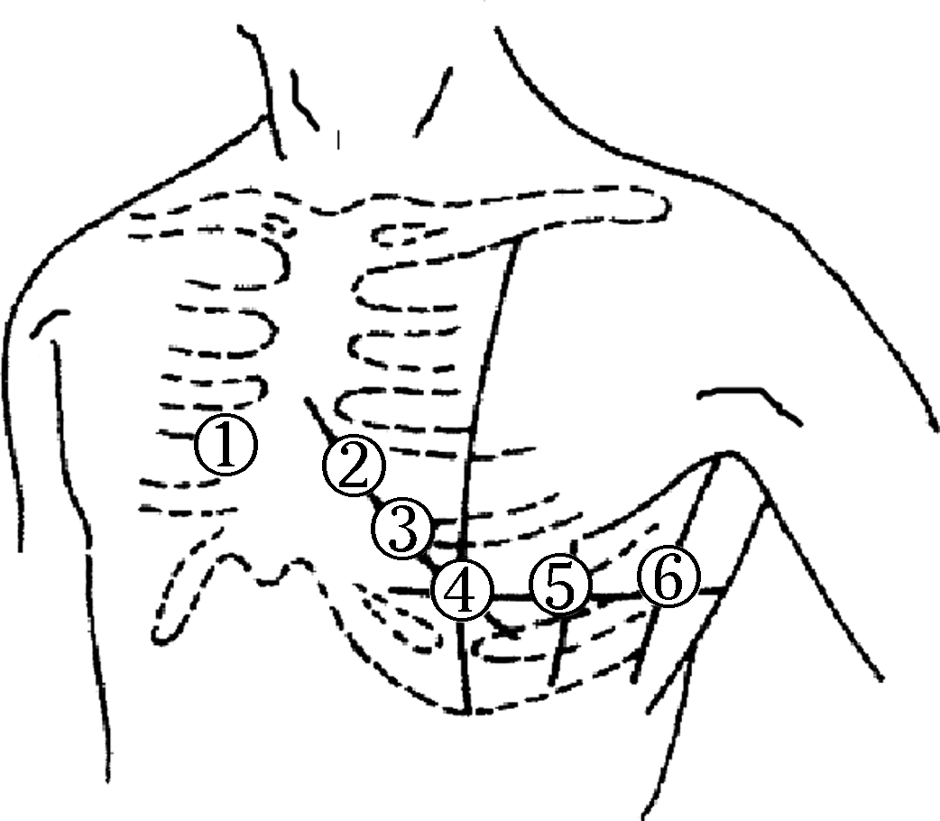 图4-15 胸导联电极放置部位示意图