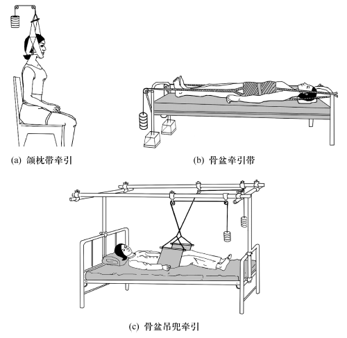 兜带牵引