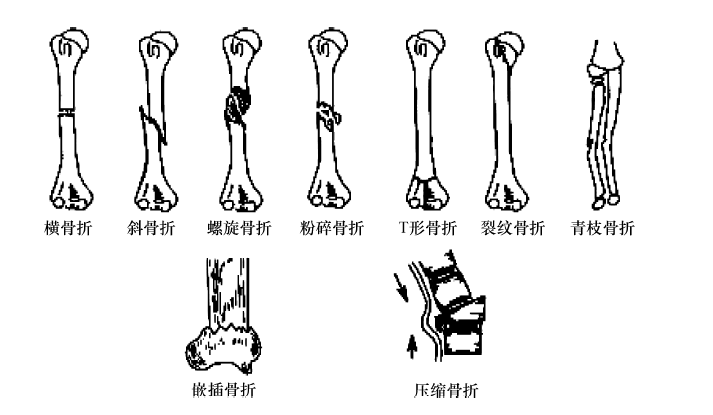 外侧裂位置图片